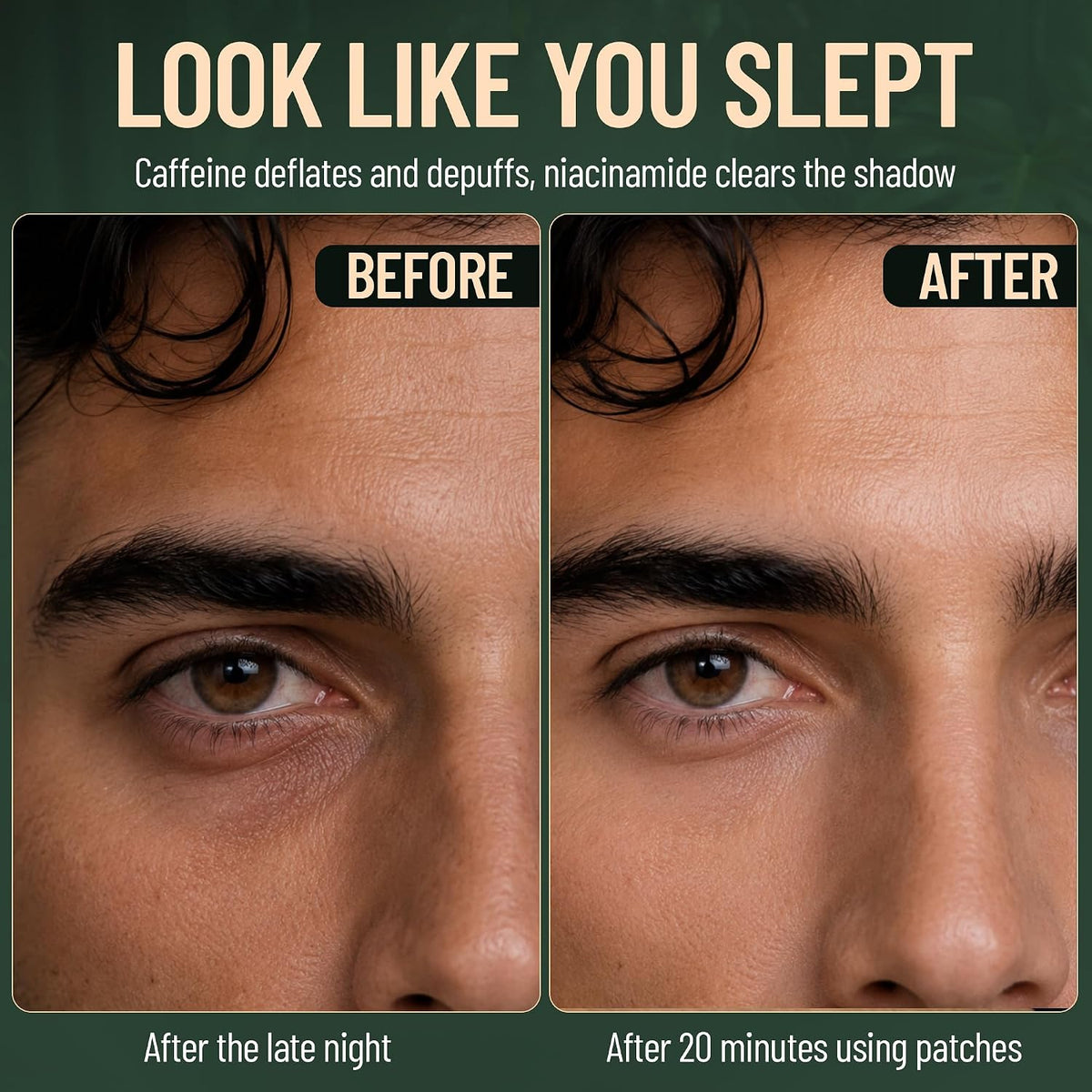 pt eye before after